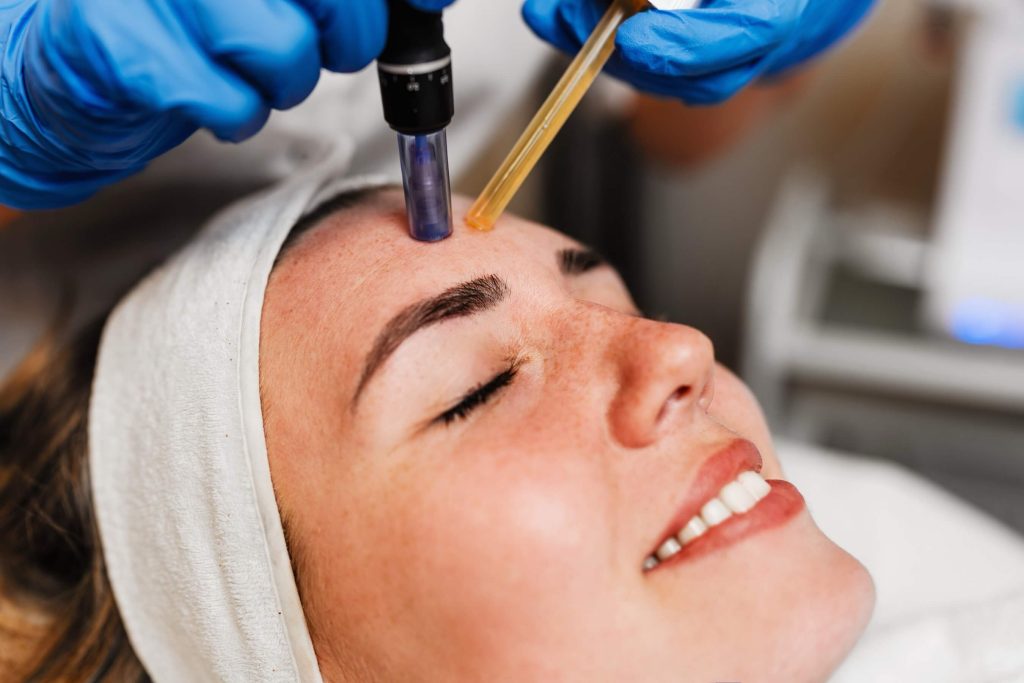 Gloved aesthetician treating a client's face with a microneedling pen.